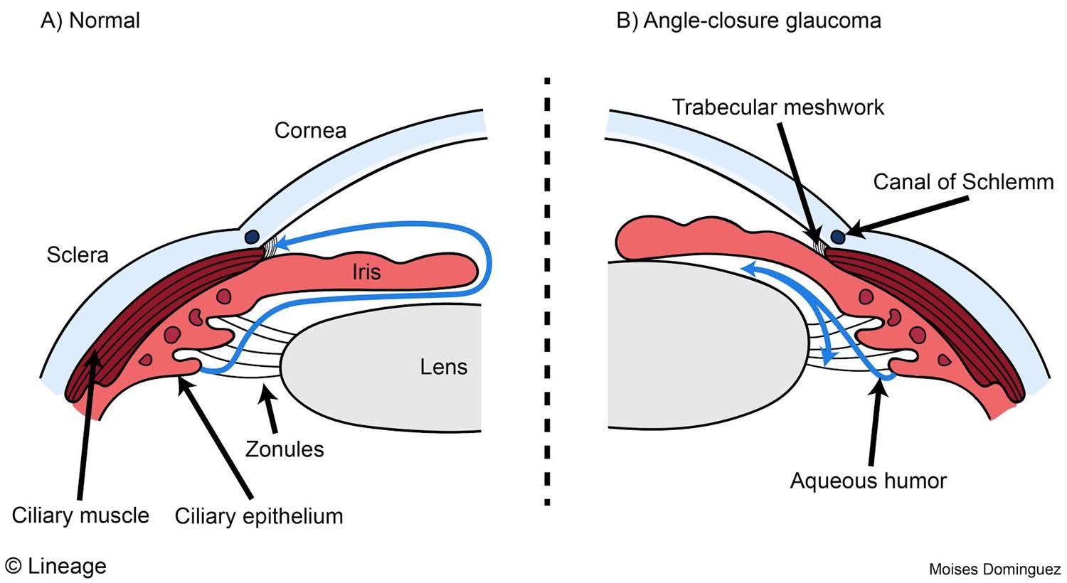 Eye Anatomy Ophthalmology Medbullets Step 2/3